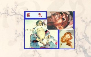 霍乱为何会被列为甲类传染病