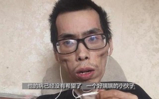 抗癌小伙阿健去世