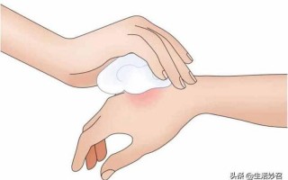 被蜜蜂蛰了怎么消肿止痒的最快 *** 